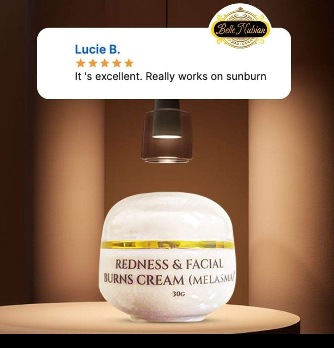 Redness and facial burns cream ( melasma)