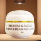 Redness and facial burns cream ( melasma)