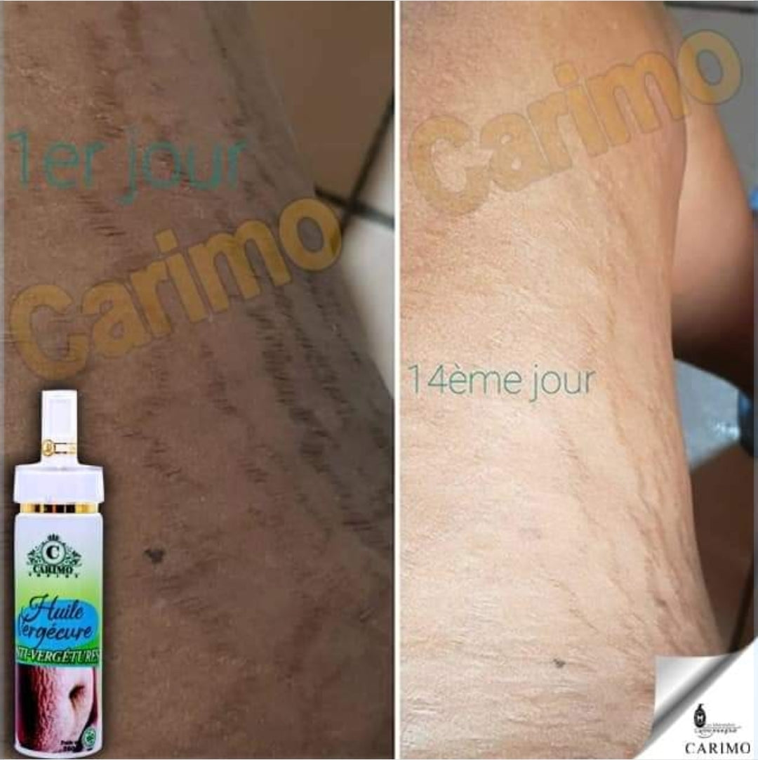 Carimo Stretch Marks Oil
